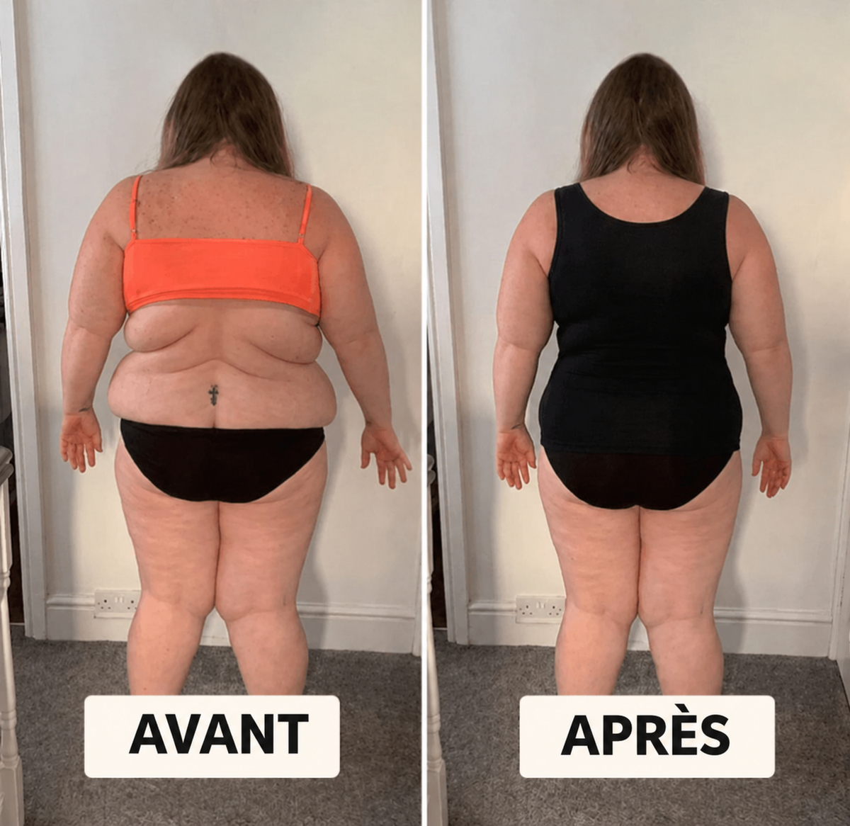 Avant / après – dos